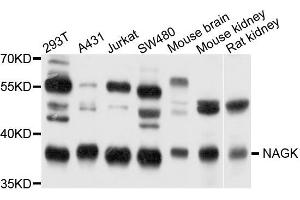 Western blot analysis of extract of various cells, using NAGK antibody. (NAGK 抗体)