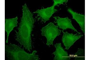 Immunofluorescence of monoclonal antibody to TMOD3 on HeLa cell.