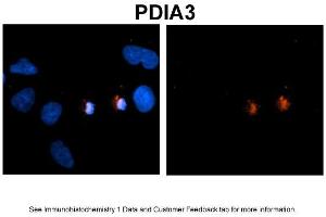 Sample Type: NT2 cells Red: Antibody Blue: DAPI Primary Dilution: 1ug/50ul antibody Secondary Antibody: Alexa goat anti-rabbit 594 Image Submitted by: Yuzhi Chen, University of Arkansas for Medical Sciences (PDIA3 抗体  (C-Term))