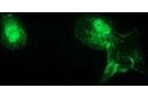 Anti-CTNNB1 mouse monoclonal antibody (ABIN2454136) immunofluorescent staining of COS7 cells transiently transfected by pCMV6-ENTRY CTNNB1 (RC208947). (CTNNB1 抗体)