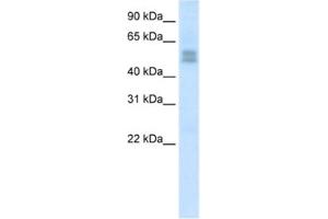 Western Blotting (WB) image for anti-LIM Homeobox Transcription Factor 1, beta (LMX1B) antibody (ABIN2461655) (LMX1B 抗体)