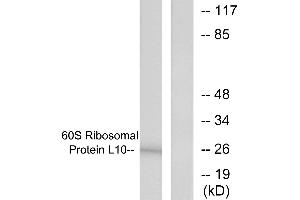 Western blot analysis of extracts from K562 cells, treated with Insulin (0. (RPL10 抗体  (Internal Region))