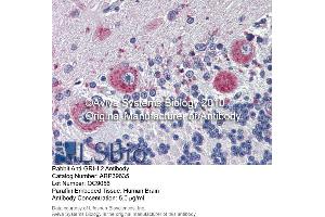 Immunohistochemistry (IHC) image for anti-Grainyhead-Like 2 (GRHL2) (Middle Region) antibody (ABIN2778358) (GRHL2 抗体  (Middle Region))