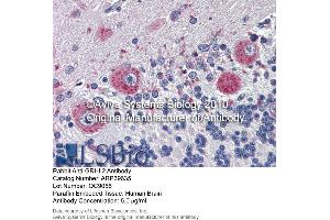 Immunohistochemistry (IHC) image for anti-Grainyhead-Like 2 (GRHL2) (Middle Region) antibody (ABIN405258) (GRHL2 抗体  (Middle Region))