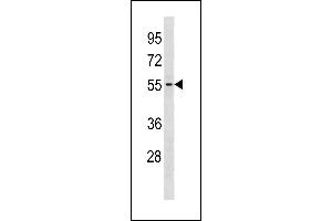 GTDC1 Antibody (Center) (ABIN1881395 and ABIN2843292) western blot analysis in Jurkat cell line lysates (35 μg/lane). (GTDC1 抗体  (AA 278-304))