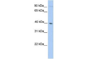 WB Suggested Anti-ODF2 Antibody Titration: 0. (ODF2 抗体  (N-Term))