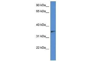 Western Blot showing SORD antibody used at a concentration of 1 ug/ml against Hela Cell Lysate (SORD 抗体  (N-Term))