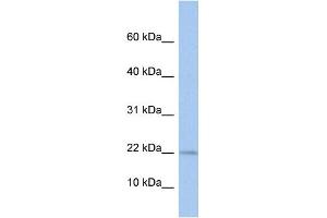 WB Suggested Anti-MPV17L Antibody Titration: 0. (MPV17L 抗体  (N-Term))