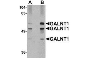 Western blot analysis of GALNT10 in rat brain tissue lysate with AP30352PU-N GALNT10 antibody at (A) 1 and (B) 2 μg/ml. (GALNT10 抗体  (N-Term))