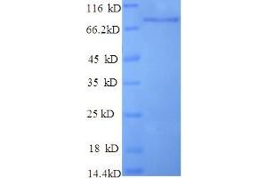 SDS-PAGE (SDS) image for Poly A Specific Ribonuclease (PARN) (AA 1-639), (full length) protein (His tag) (ABIN5710067)