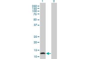 Western Blot analysis of FABP1 expression in transfected 293T cell line by FABP1 MaxPab polyclonal antibody. (FABP1 抗体  (AA 1-127))