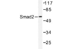 Image no. 1 for anti-SMAD, Mothers Against DPP Homolog 2 (SMAD2) antibody (ABIN271912) (SMAD2 抗体)