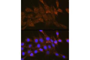 Immunofluorescence analysis of NIH-3T3 cells using OSBP Rabbit pAb (ABIN1681171, ABIN3018393, ABIN3018394 and ABIN6220458) at dilution of 1:100 (40x lens). (OSBP 抗体  (AA 508-807))