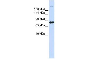 CAD antibody used at 1 ug/ml to detect target protein. (CAD 抗体  (N-Term))
