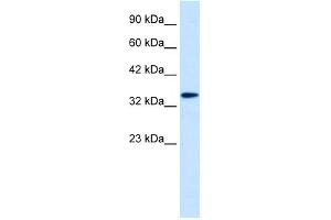 WB Suggested Anti-DLX6 Antibody Titration: 0. (DLX6 抗体  (Middle Region))