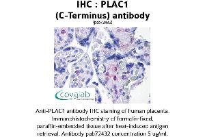 Image no. 1 for anti-Placenta-Specific 1 (PLAC1) (C-Term) antibody (ABIN1738141) (PLAC1 抗体  (C-Term))