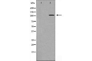 Western blot analysis of EPHB4 expression in 293 cell extract,The lane on the left is treated with the antigen-specific peptide. (EPH Receptor B4 抗体  (Internal Region))