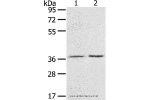 Western blot analysis of Mouse stomach tissue and A431 cell, using PDLIM4 Polyclonal Antibody at dilution of 1:800 (PDLIM4 抗体)