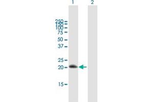 Western Blot analysis of RGS10 expression in transfected 293T cell line by RGS10 MaxPab polyclonal antibody. (RGS10 抗体  (AA 1-181))