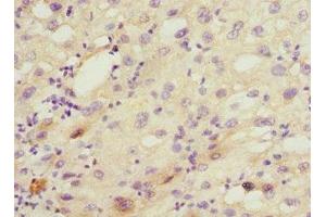 Immunohistochemistry (IHC) image for anti-Cytochrome P450, Family 2, Subfamily C, Polypeptide 18 (CYP2C18) (AA 231-490) antibody (ABIN7149242)