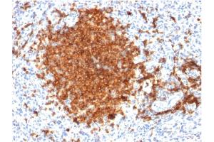 Formalin-fixed, paraffin-embedded human Spleen stained with CD22-Monospecific Mouse Monoclonal Antibody (BLCAM/1795).