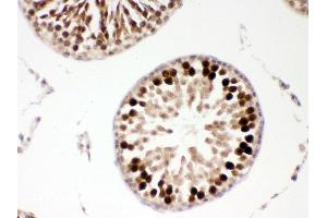 Anti- PBK Picoband antibody, IHC(P) IHC(P): Rat Testis Tissue (PBK 抗体  (AA 71-322))