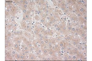 Immunohistochemical staining of paraffin-embedded liver tissue using anti-PROM2mouse monoclonal antibody. (Prominin 2 抗体)