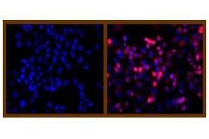 Immunofluorescence (IF) image for anti-His Tag antibody (ABIN126947) (His Tag 抗体)