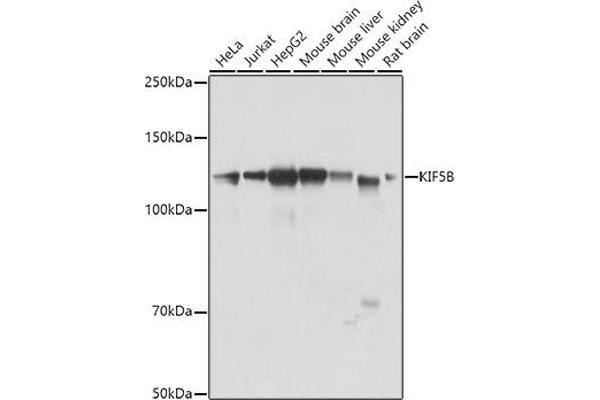 KIF5B 抗体  (AA 650-770)