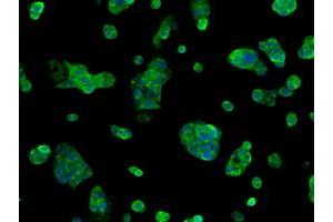 Immunofluorescence (IF) image for anti-Sorbitol Dehydrogenase (SORD) antibody (ABIN1501072) (SORD 抗体)