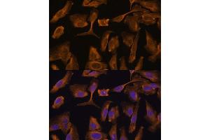Immunofluorescence analysis of U-2 OS cells using MTMR4 Polyclonal Antibody (ABIN7268764) at dilution of 1:100 (40x lens). (MTMR4 抗体  (AA 920-1195))