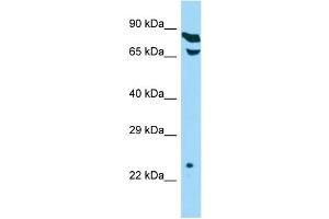 Host: Rabbit Target Name: THOC7 Sample Type: HepG2 Whole Cell lysates Antibody Dilution: 1. (THOC7 抗体  (C-Term))