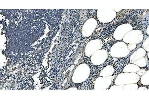 IHC analysis of LSM8 using anti-LSM8 antibody (ABIN7599579). (NAA38 抗体  (AA 1-96))