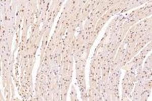 Immunohistochemistry analysis of paraffin-embedded mouse heart using,SUN2 (ABIN7075502) at dilution of 1: 4000
