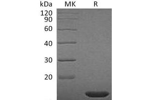 Western Blotting (WB) image for Fibroblast Growth Factor 2 (Basic) (FGF2) (Active) protein (ABIN7321251) (FGF2 蛋白)