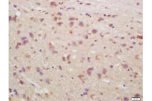 Formalin-fixed and paraffin embedded rat brain labeled with Anti-CHRM4/mAChR M4 Polyclonal Antibody, Unconjugated (ABIN1387838) at 1:200, followed by conjugation to the secondary antibody and DAB staining (CHRM4 抗体  (AA 1-31))
