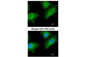 ICC/IF Image Immunofluorescence analysis of paraformaldehyde-fixed HeLa, using Annexin A1, antibody at 1:200 dilution. (Annexin a1 抗体)