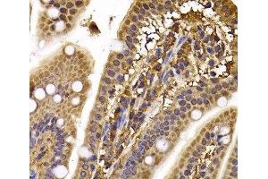 Immunohistochemistry of paraffin-embedded Mouse ileum using CLASP1 Polyclonal Antibody at dilution of 1:100 (40x lens). (CLASP1 抗体)