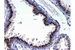 Image no. 2 for anti-Golgi Membrane Protein 1 (GOLM1) antibody (ABIN1498494) (GOLM1 抗体)