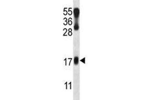 LMO2 antibody western blot analysis in NCI-H460 lysate.
