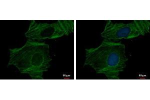 ICC/IF Image alpha Actin (cardiac muscle) antibody detects alpha Actin (cardiac muscle) protein at cytoskeleton by immunofluorescent analysis. (ACTC1 抗体)