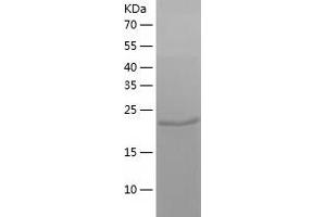 Western Blotting (WB) image for Zinc Finger Protein 266 (ZNF266) (AA 22-254) protein (His tag) (ABIN7125781) (ZNF266 Protein (AA 22-254) (His tag))