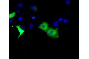 Anti-BTK mouse monoclonal antibody (ABIN2452836) immunofluorescent staining of COS7 cells transiently transfected by pCMV6-ENTRY BTK (RC211582). (BTK 抗体)