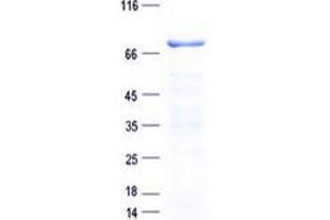 Western Blotting (WB) image for Aminolevulinate, delta-, Synthase 1 (ALAS1) protein (His tag) (ABIN5505552)
