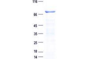 Validation with Western Blot (ALAS1 Protein (His tag))