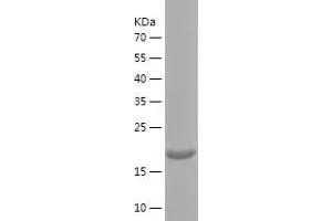 Western Blotting (WB) image for Collagen, Type XV, alpha 1 (COL15A1) (AA 1212-1388) protein (His tag) (ABIN7283992) (COL15A1 Protein (AA 1212-1388) (His tag))