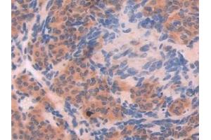 Detection of XDH in Mouse Ovary Tissue using Polyclonal Antibody to Xanthine Dehydrogenase (XDH) (XDH 抗体  (AA 231-416))