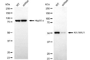 Western blotting analysis using KATNAL1 antibody (ABIN7799159). (KATNAL1 抗体)