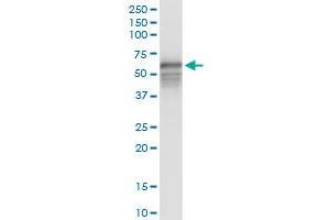 Immunoprecipitation (IP) image for anti-Homocysteine-Inducible, Endoplasmic Reticulum Stress-Inducible, Ubiquitin-Like Domain Member 1 (HERPUD1) (AA 1-391) antibody (ABIN523184)