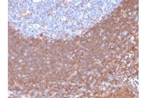 Immunohistochemistry (IHC) image for anti-Calpastatin (CAST) antibody (ABIN6940960)